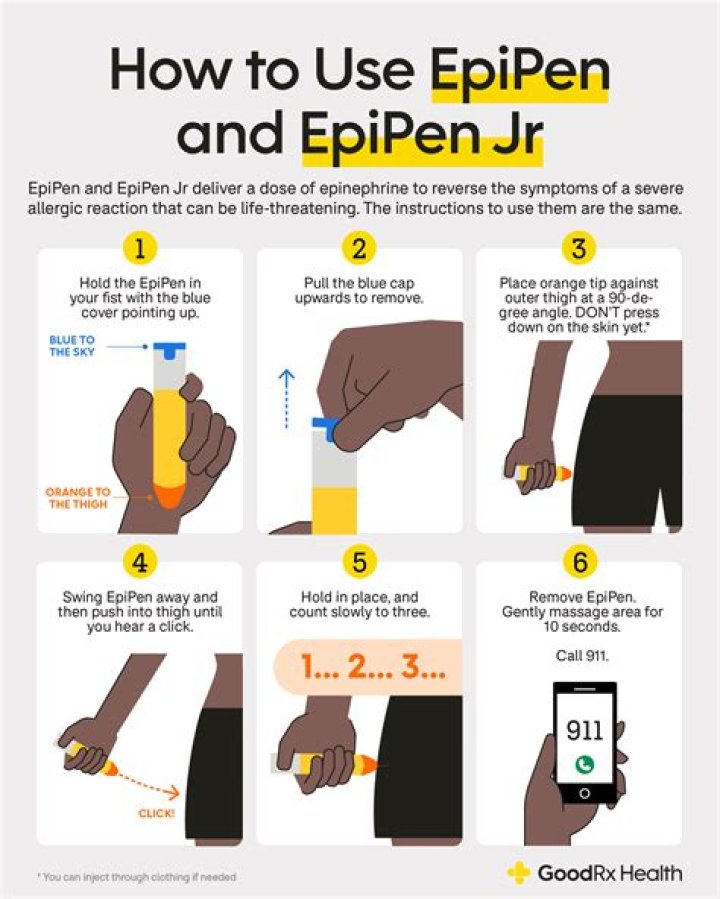 Do I need an EpiPen for wasp sting?