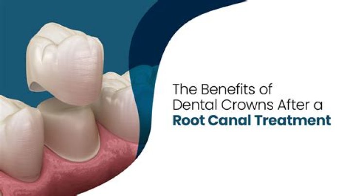 Does crown after root canal hurt?