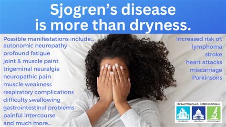 How do you get Sjogren's?