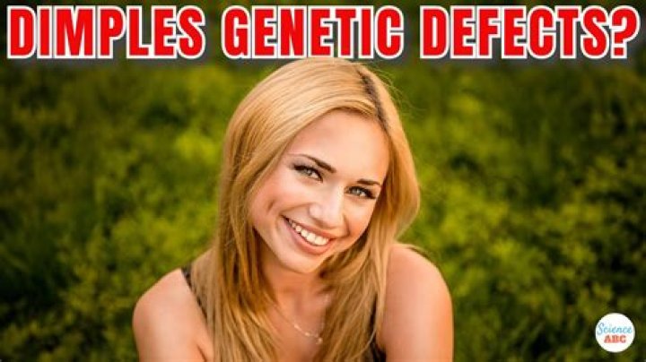 Is dimple genetic?