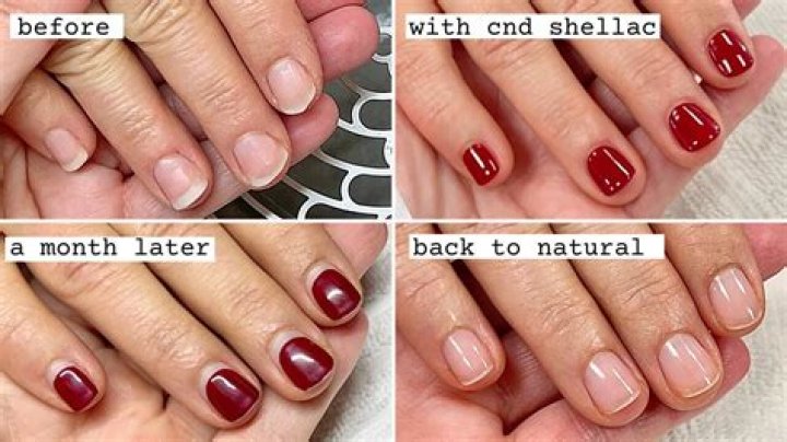 What's better SNS or Shellac?