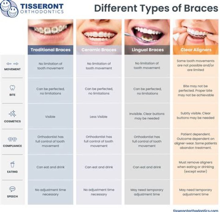 What braces are better?