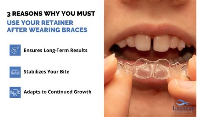 What happens if you leave your retainer in Retainer Brite for too long?