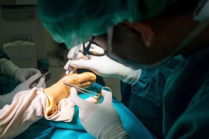 When is it too late for bunion surgery?
