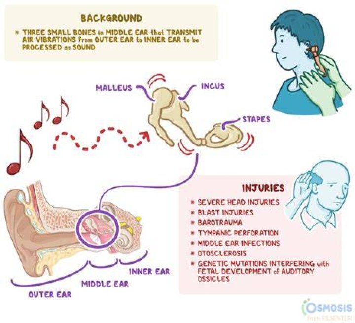 Why do I hear music when I lay down?